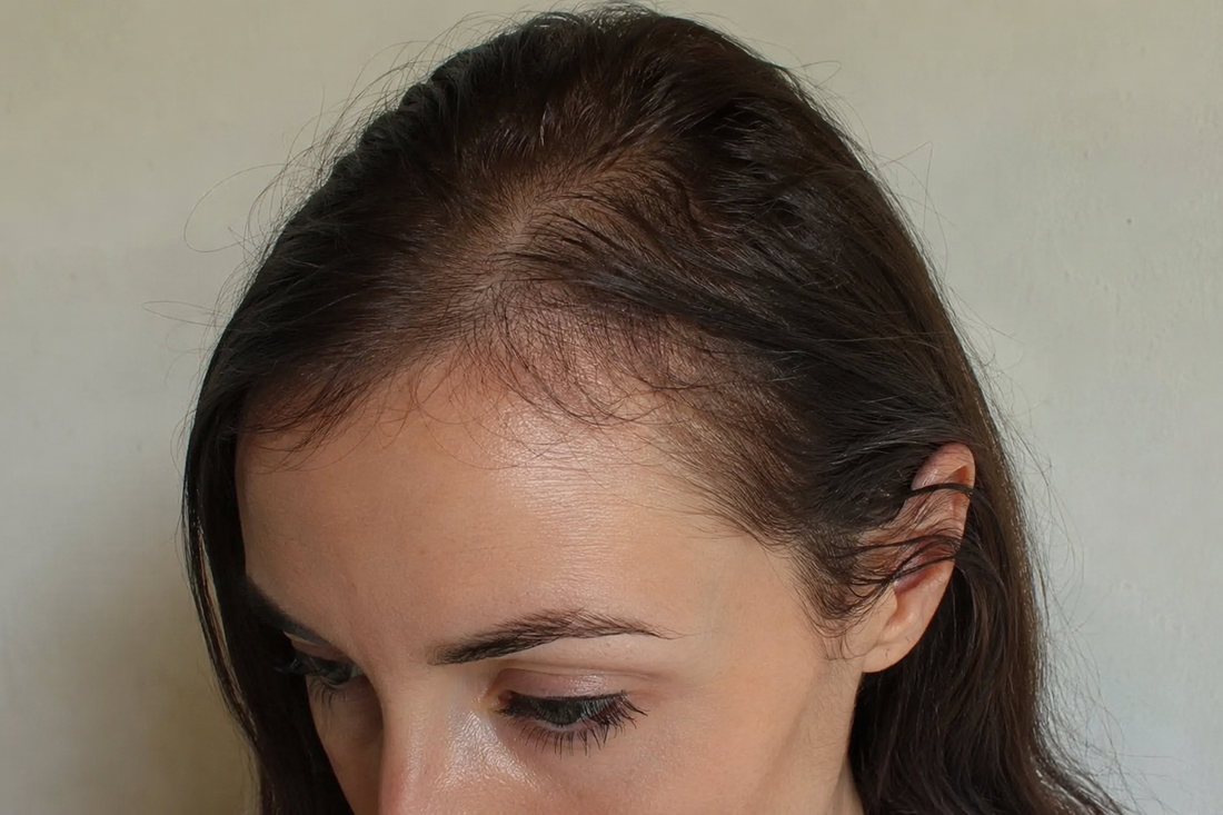Before Hair Appearance