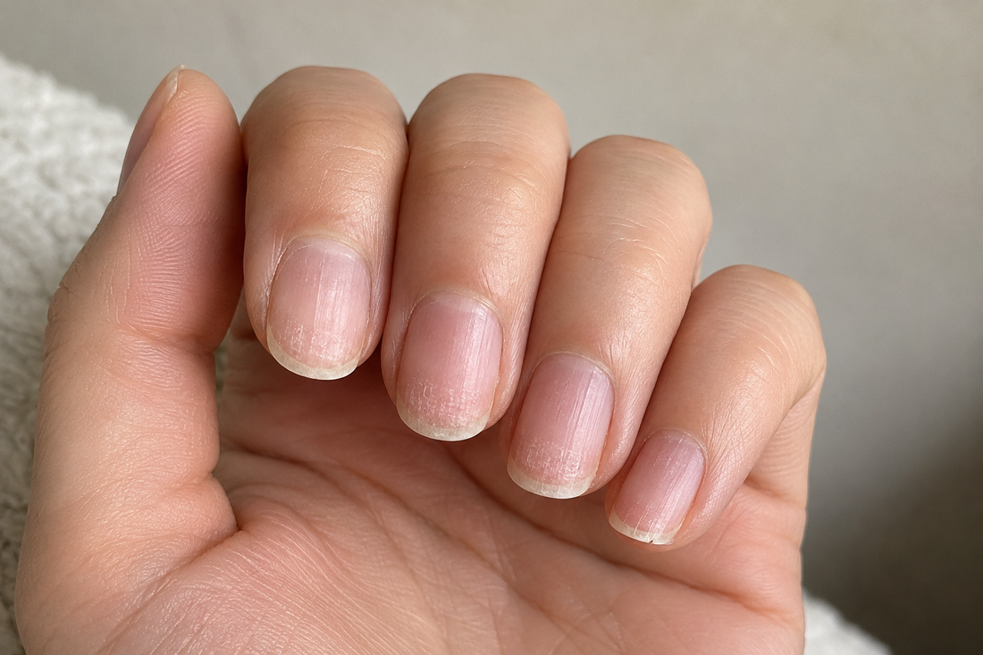 Before Nail Appearance